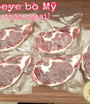Ribeye Bò Mỹ